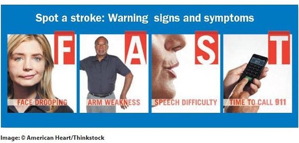 spotting a stroke