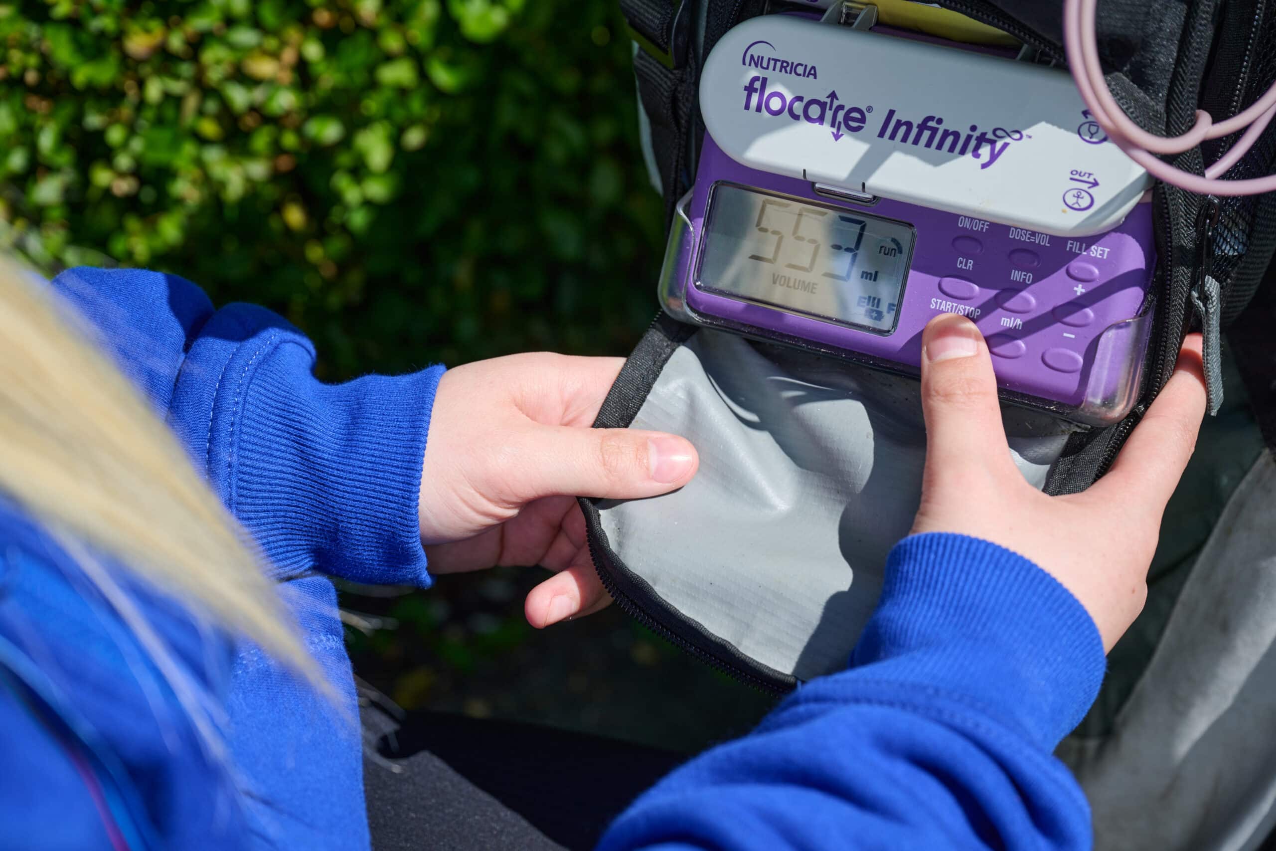 Enteral Feeding in Rotherham and Sheffield